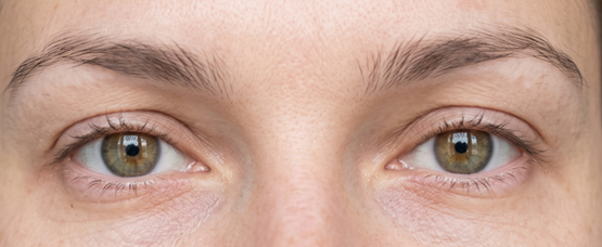 Lashcode Lash & Brow Lamination - before